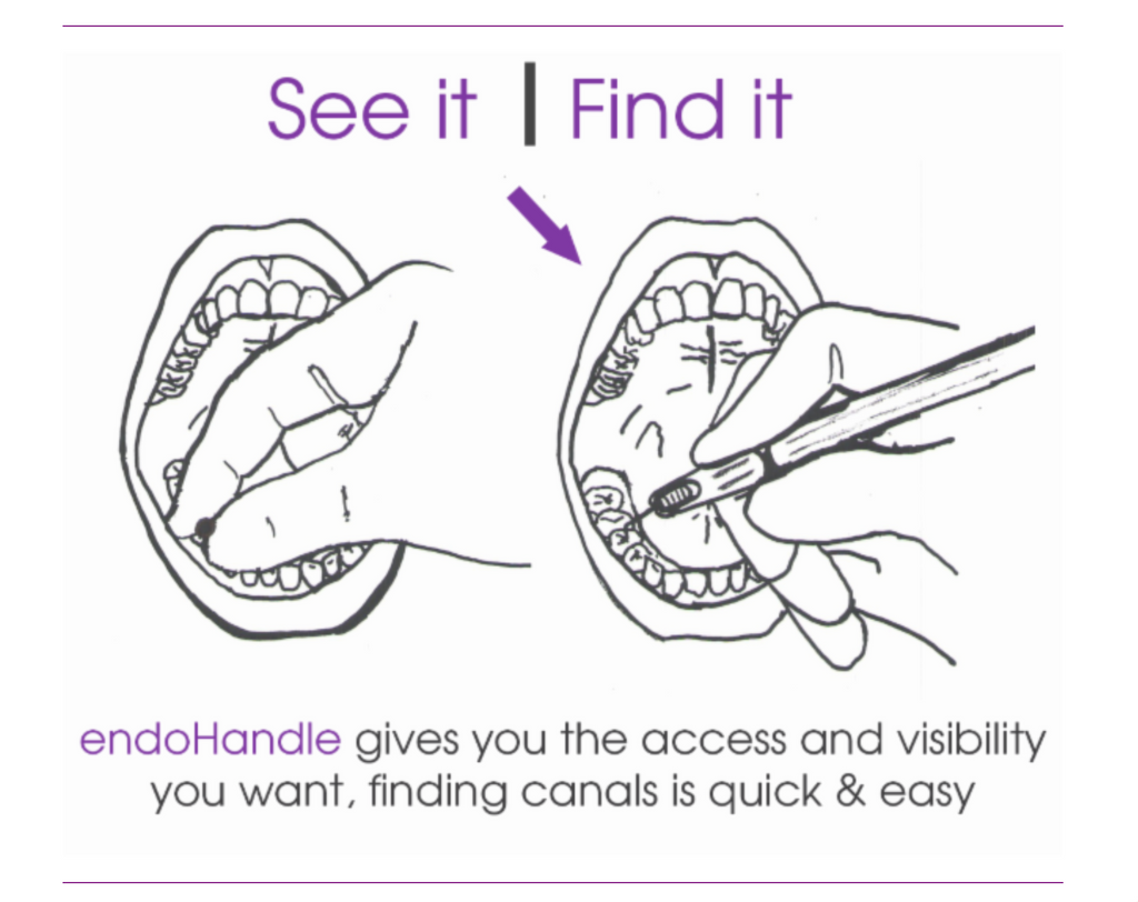Easy Access and better visibility with the EndoHandle