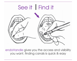 Easy Access and better visibility with the EndoHandle